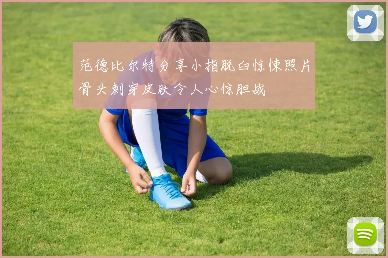 范德比尔特分享小指脱臼惊悚照片骨头刺穿皮肤令人心惊胆战